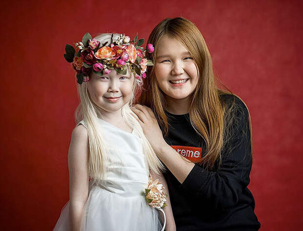 9-летняя девочка-альбинос из Якутии: модельные агентства наперебой предлагают ей контракты. Фото