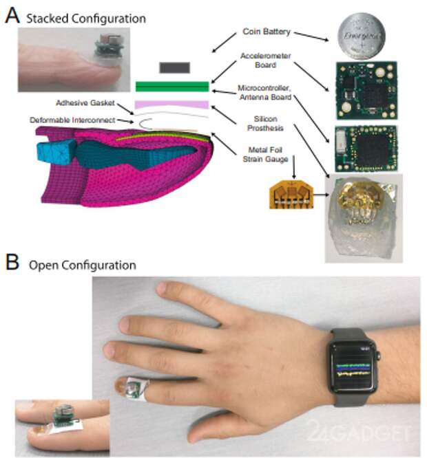 Ногтевой датчик от IBM выявляет симптомы болезней (4 фото + видео)