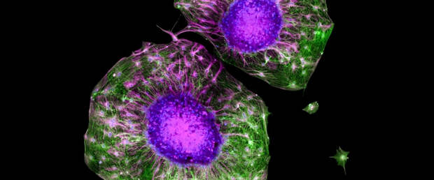 Занятия спортом усиливают рост нейронов в четыре раза