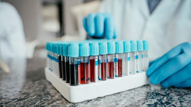 Новый анализ крови предскажет деменцию у женщин за 25 лет до начала