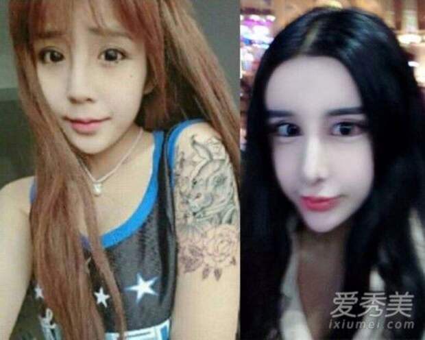 15-летняя китаянка пережила массу пластических операций, чтобы вернуть бойфренда внешность, операция