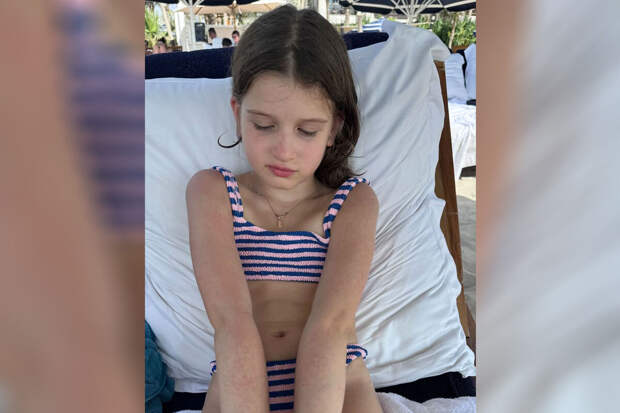 Телеведущая Бородина сообщила, что у ее дочери обострилась аллергия в США