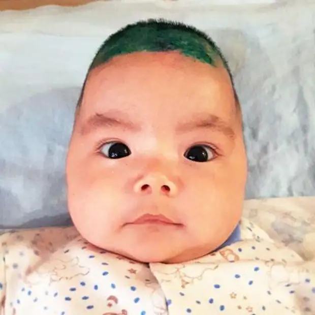 Расул Темралиев, 3 месяца, деформация черепа, требуется лечение специальными шлемами-ортезами, 201 070 ₽