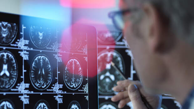 Терапевт назвала недостаток сна одним из факторов развития болезни Альцгеймера