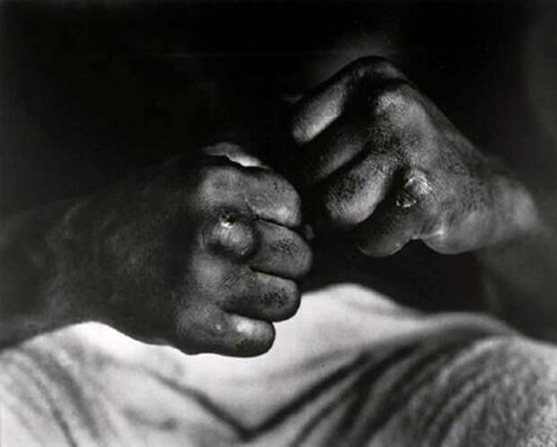 Руки Мухаммеда Али после боя с Генри Купером, 1966 год. знаменитости, люди, фото