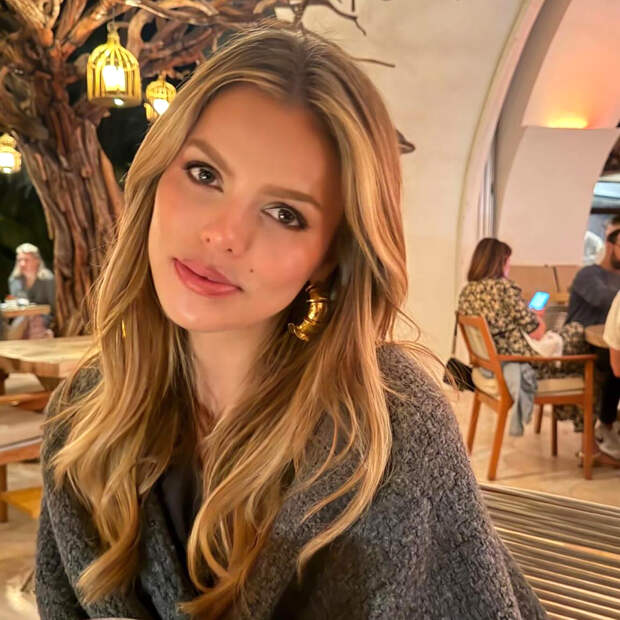 Популярная модель показала внешность после удаления филлеров из губ