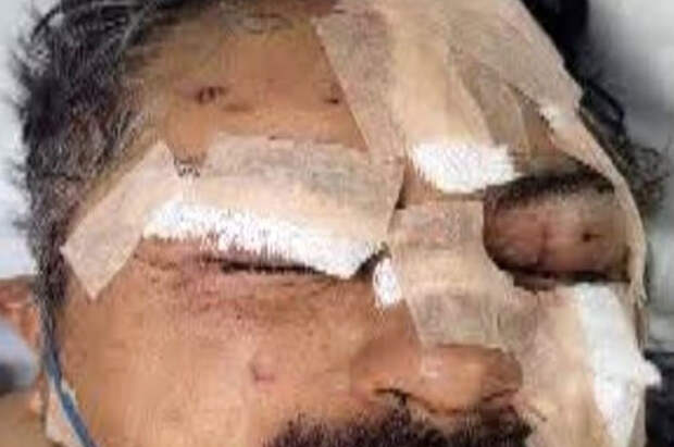 В Мексике мужчиина открыл львам клетки и чудом выжил