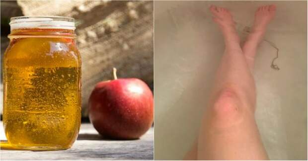 Она набрала ванну и добавила 500 мл яблочного уксуса. Через 30 минут ее кожу было не узнать!