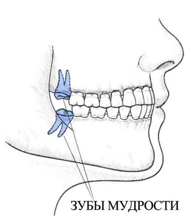 Зачем зубы мудрости. Зубы мудрости где расположены. Расположение зуба мудрости в челюсти. Где растет зуб мудрости. Гле растёт зуб мудрости.