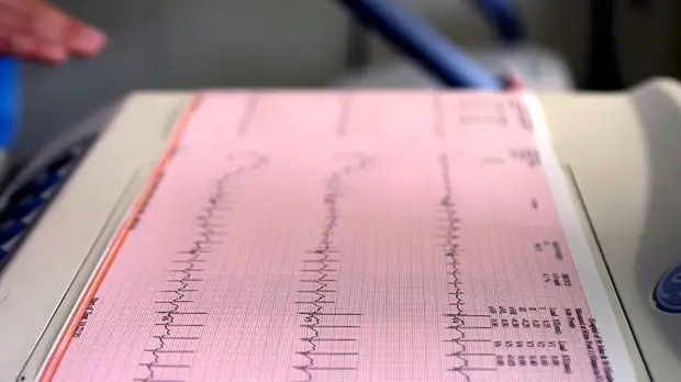 «Снижает заболеваемость в 19 раз»: российские медики испытали новый метод борьбы с аритмией после операций на сердце