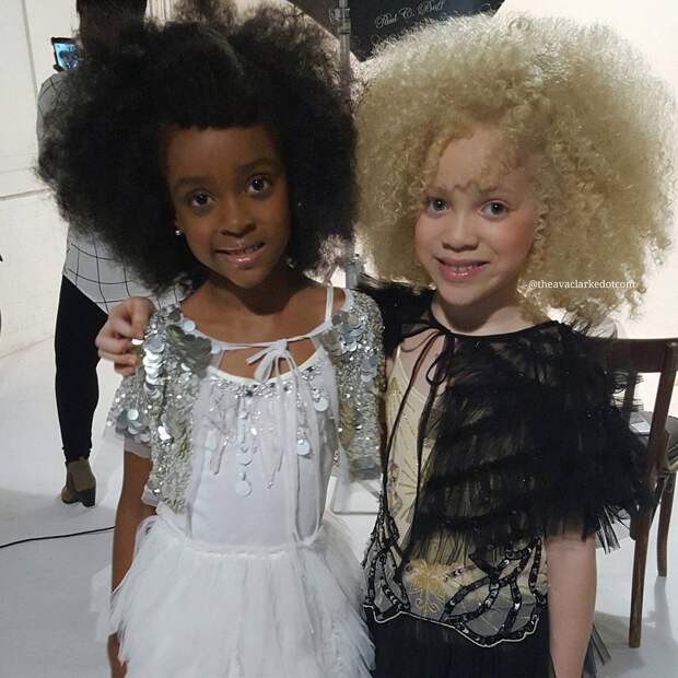 Афроамериканская девочка-альбинос покоряет мир моды