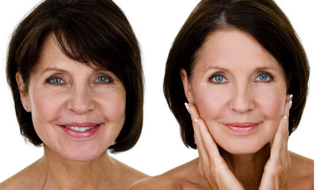 face-lift-services | Robertson Cosmetic Center