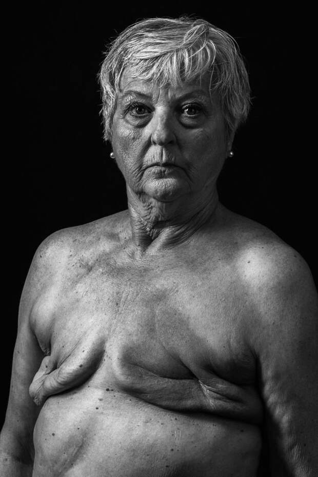 Рак груди, Хью Кидд national geographic, конкурс, красота, природа, удивительно, фото, фотография, фотоподборка