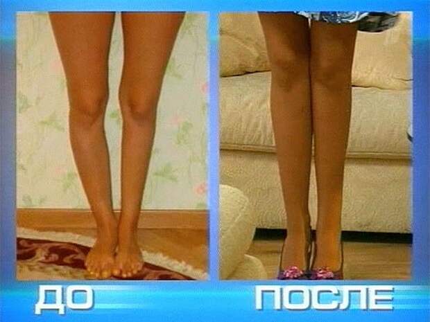 Одна нога короче другой фото