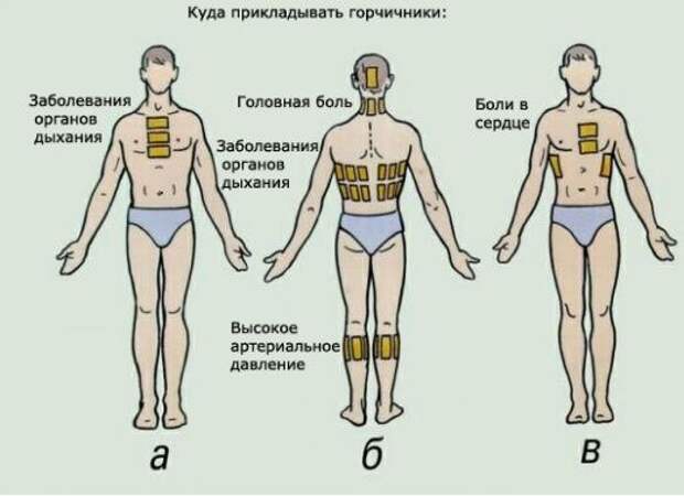1444238958_kak_stavit__gorchichniki (523x380, 31Kb)