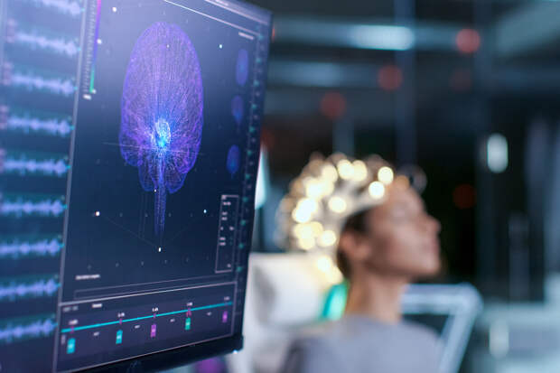 Открыт новый способ омоложения клеток мозга