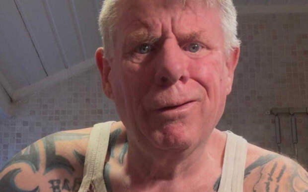 Пожилой британец не захотел тратиться на стоматолога и выдернул зуб гантелью