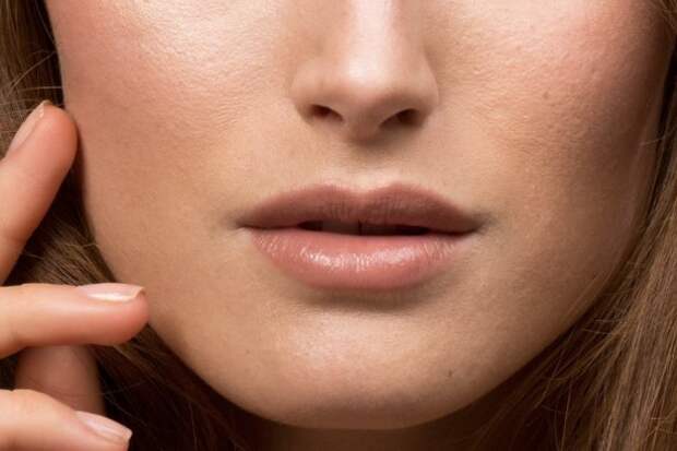 расширенные поры