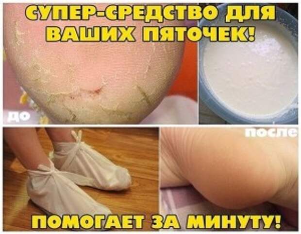getImage (3)