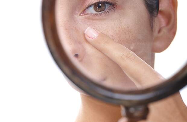 Как сузить поры на коже: 10 простых способов