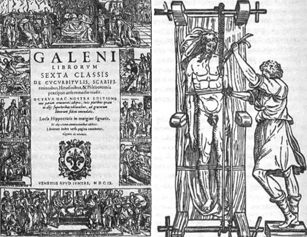 От Гиппократа до Пирогова, военно-полевая хирургия в разные эпохи