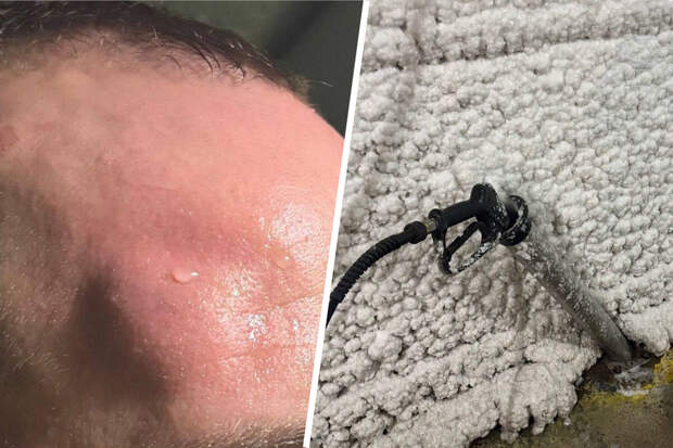 В Петербурге в голову посетителя автомойки отлетел пистолет высокого давления