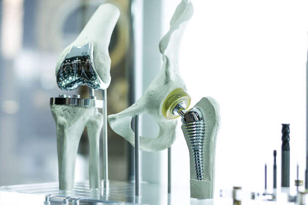 В Самаре создали гидрогели для 3D-печати биоаналогов костей и суставов