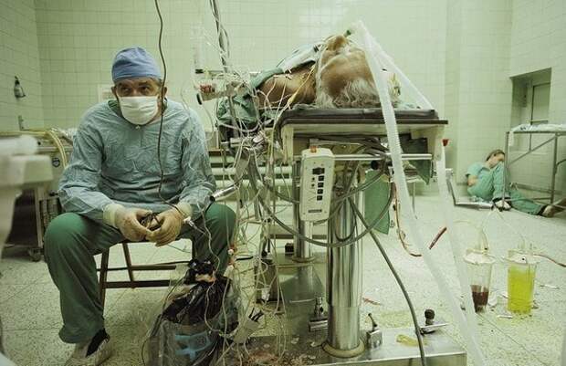 Снимок хирурга после проведенной им 23-часовой операции на сердце