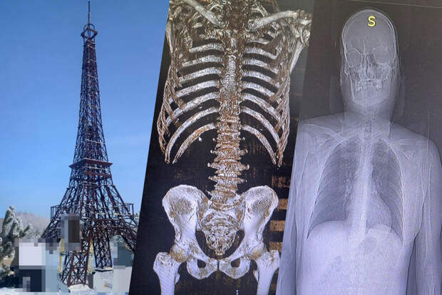 В Саратовской области мужчина сломал ребра, упав с копии Эйфелевой башни