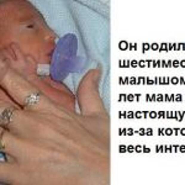 Он родился шестимесячным малышом. Через 11 лет мама написала настоящую правду, из-за которой ахнул весь интернет!