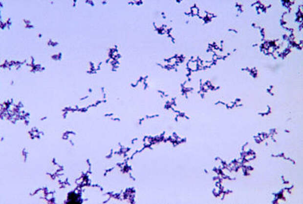 Propionibacterium acnes под световым микроскопом