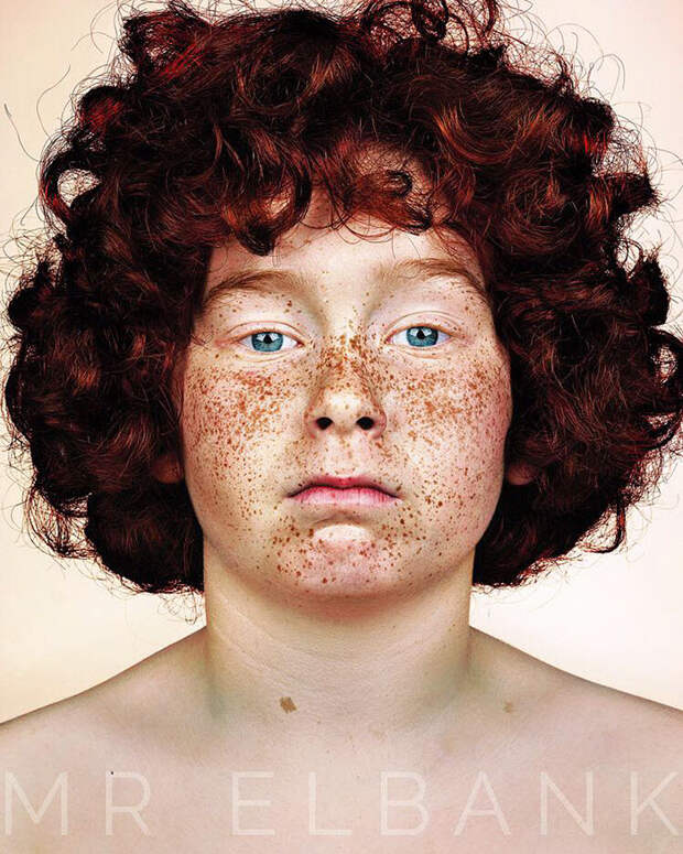 freckles-portrait-photography-brock-elbank-103__700