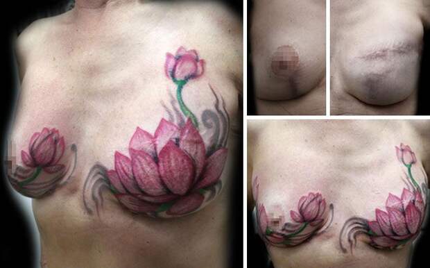 Татуировщица бесплатно перекрывает шрамы женщинам, Флавия Карвальo, Flavia Carvalho