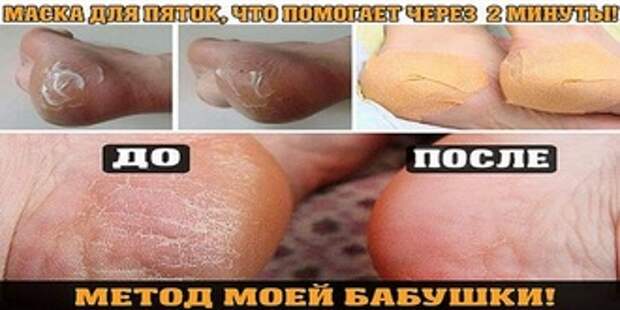 24a0011b26460a501d0b4bb2259c02ce