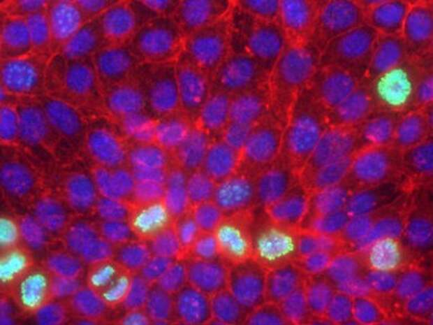 Стволовая клетка — друг или рак?
