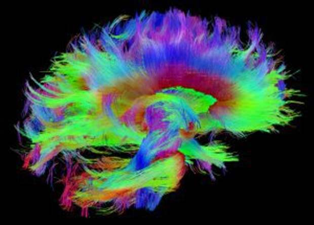 A macro-level map of the brain's white matter. Image credit: The Human Connectome Project