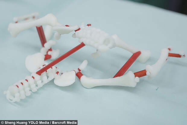 Успешная операция по разделению сиамских близнецов с применением технологий 3D-печати 3d-печать, близнецы, операция