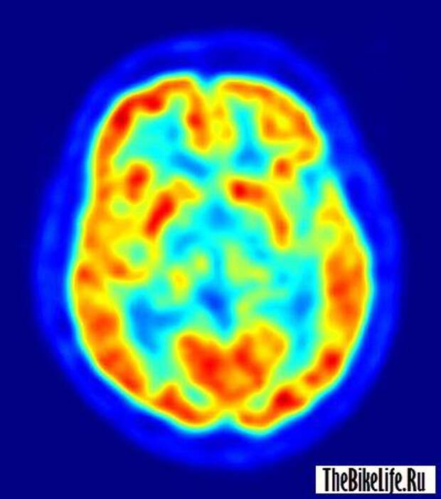b2ap3_thumbnail_active-mind-398x450.jpg