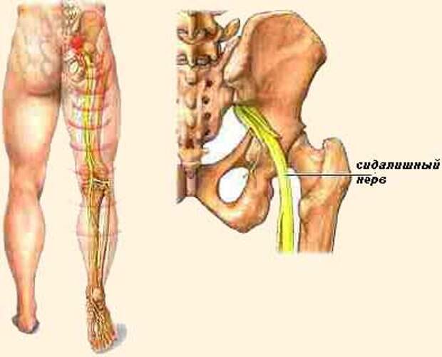 Седалищный нерв схема