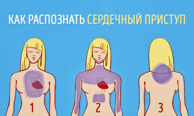 как распознать сердечный приступ заранее