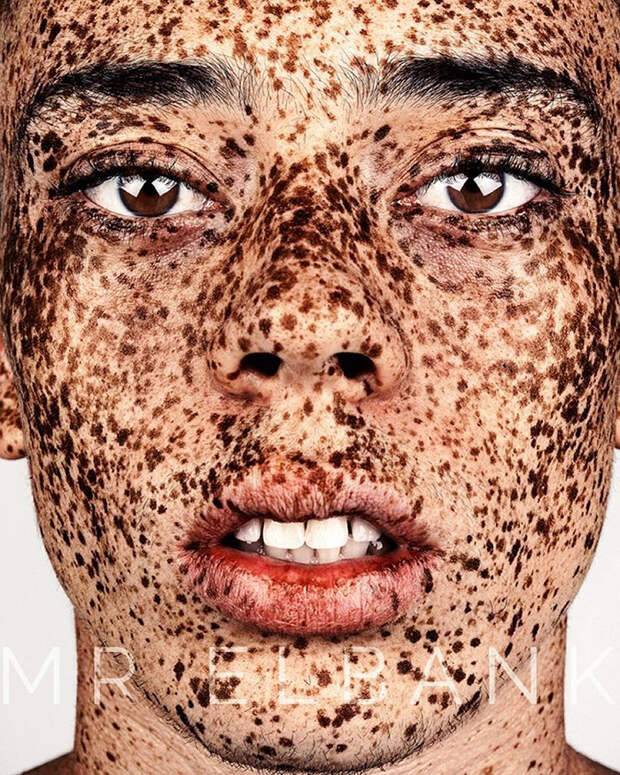 freckles-portrait-photography-brock-elbank-139__700
