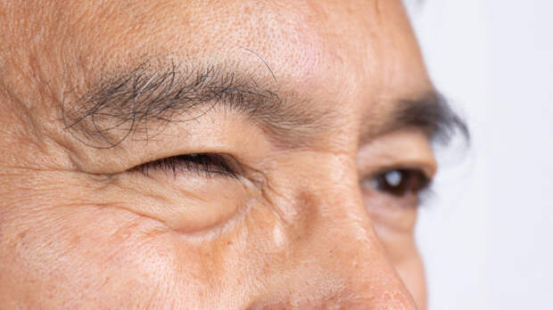 Офтальмолог Казанцев: подёргивание века чаще всего вызывает стресс и недосып