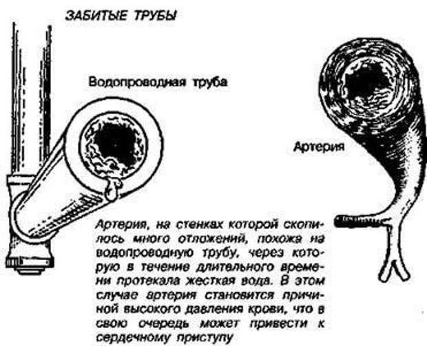 Шпоры и образования в суставах: Тест Брэгга на заизвесткованность Шпоры и образования в суставах: Тест Брэгга на заизвесткованность