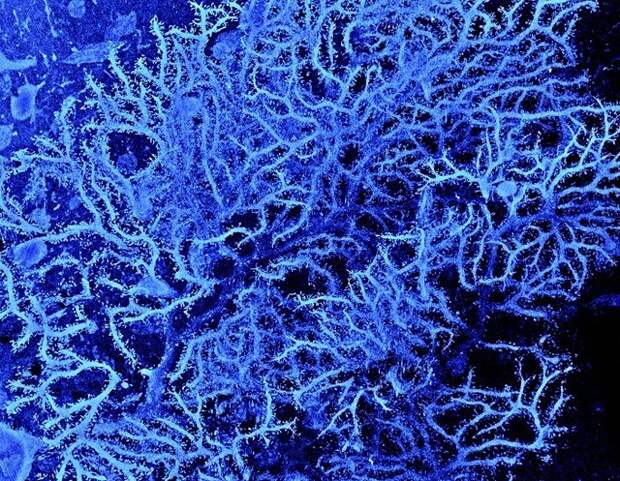 Разновидность нервных клеток из коры мозжечка крысы. Изображение получено с помощью сканирующего электронного микроскопа.
