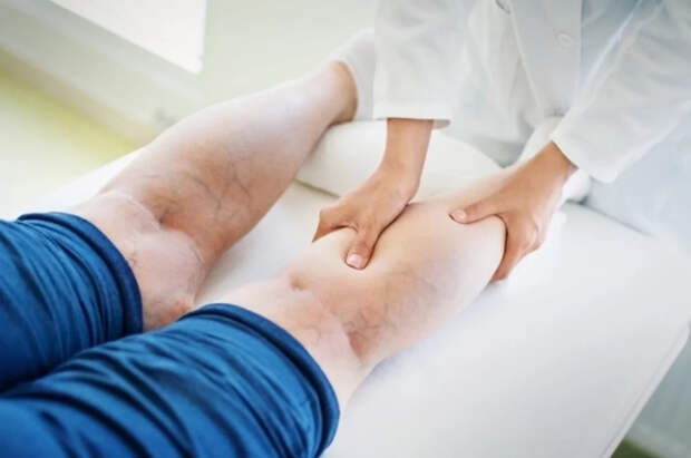 Флеболог Смирнова: сидячая работа ускоряет развитие варикоза