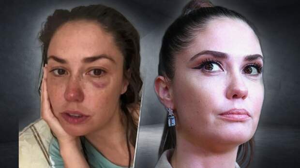 «Выгнал с детьми на улицу»: 35-летняя Агата Муцениеце пережила скандальный развод, год судилась за сына и родила третьего ребенка от Петра Дранги