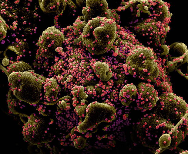 picture_of_the_day_virus_crown_3