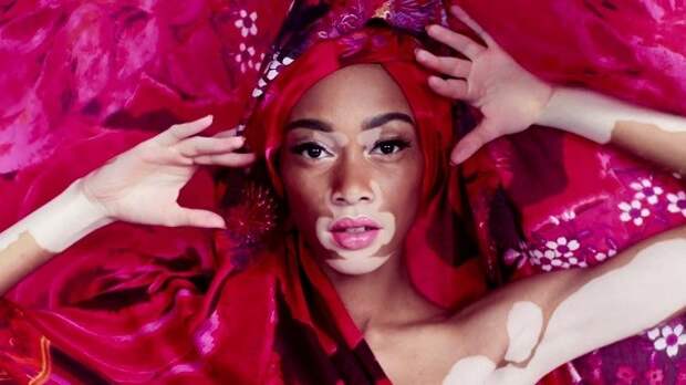 winnie-harlow-610x343