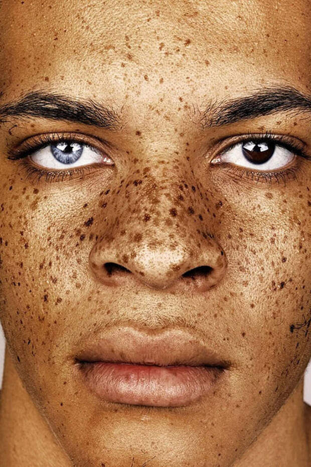 freckles-portrait-photography-brock-elbank-126__700