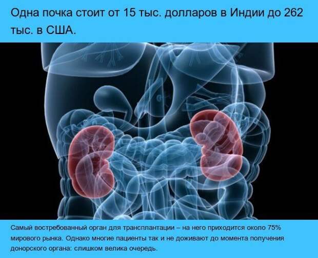 Цена органов мужчины. Сколько стоит почка. Сколько стоят органы. Черный рынок человеческих органов. Стоимость всех органов.